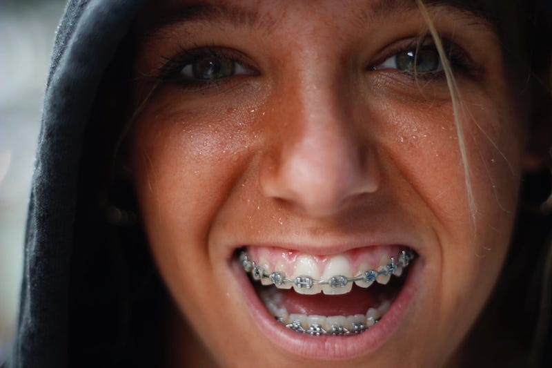 Girl smiling with brackets
