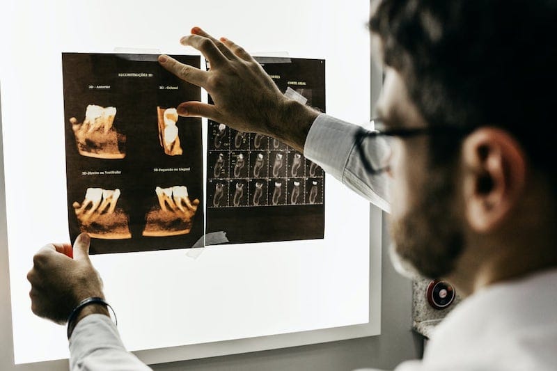 Dentista mirado una radiografa
